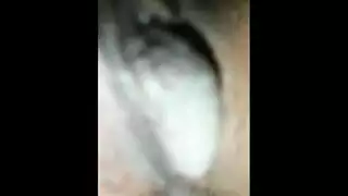 البنطلون فيه ثقب